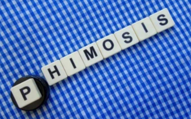 phimosis treatment