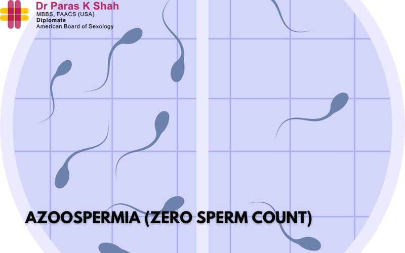 Azoospermia