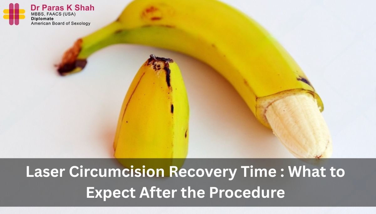 Laser Circumcision Recovery Time What to Expect After the Procedure