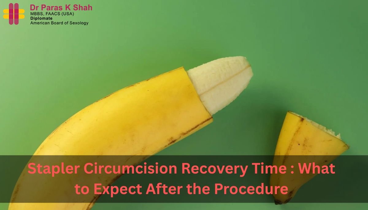 Stapler Circumcision Recovery Time What to Expect After the Procedure